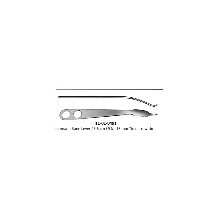 Hohmann Bone Lever
